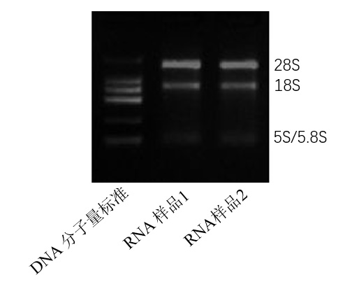 图11-2-总RNA电泳图.jpg