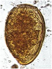 图21-16 肺吸虫卵.jpg